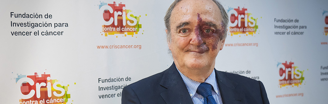 Projet sur le cancer du pancréas