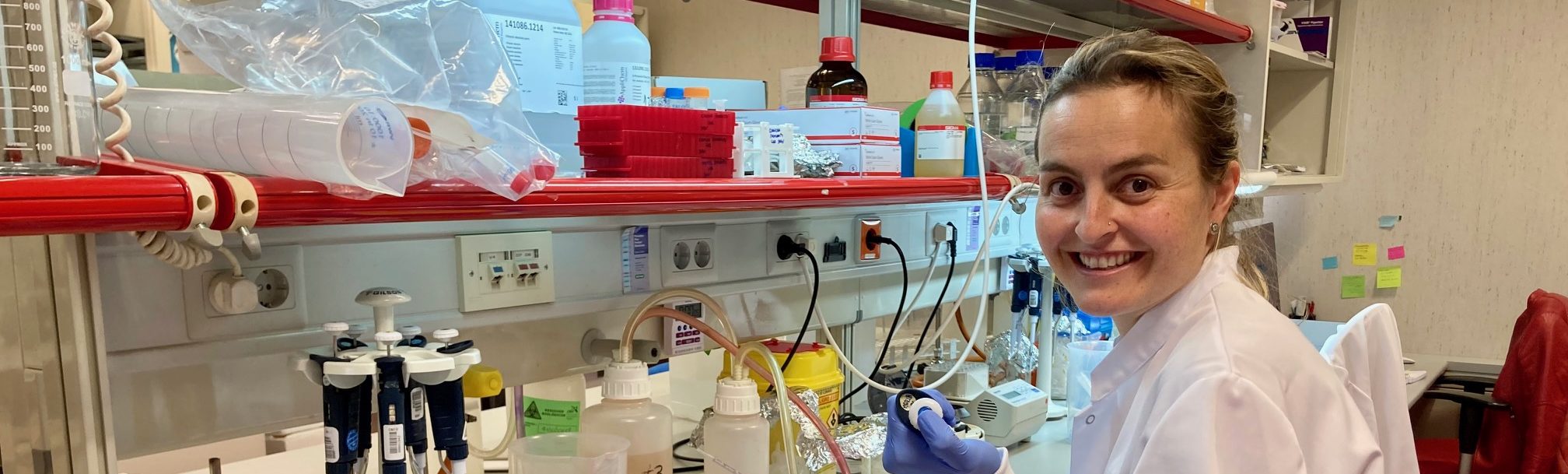 Projet CRIS sur la métastase du cancer du sein